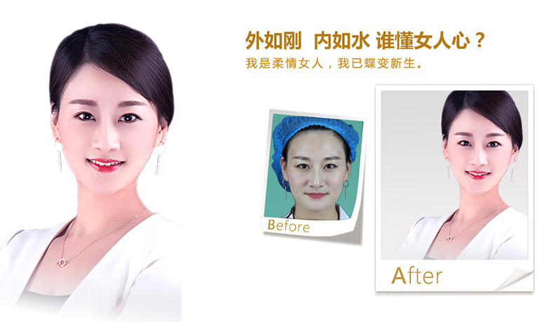 南川V脸、线雕隆鼻